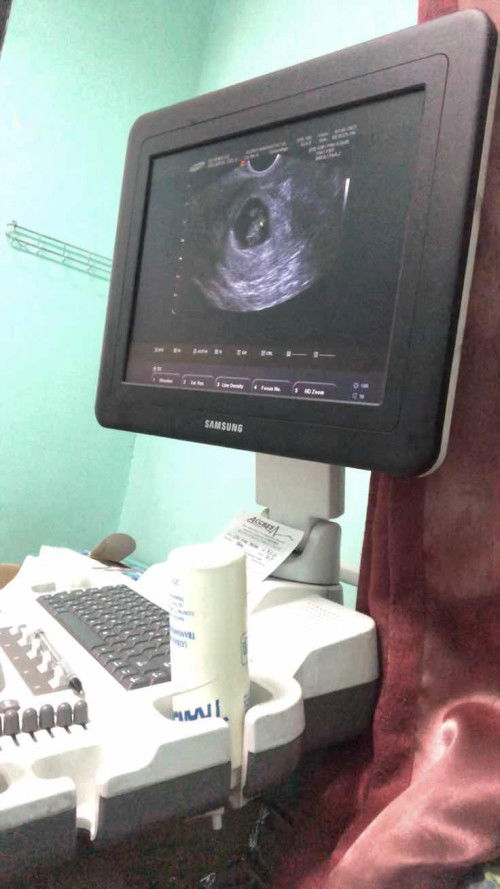 My second baby❤️