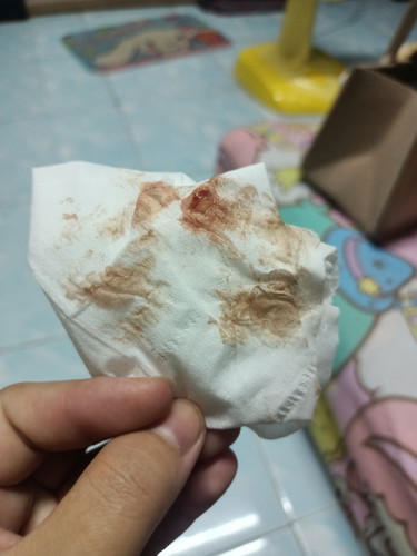 กระตุ้นคลอด