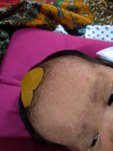 Adakah mom yg bayinya juga keluar seperti ini, diapakan ya mom