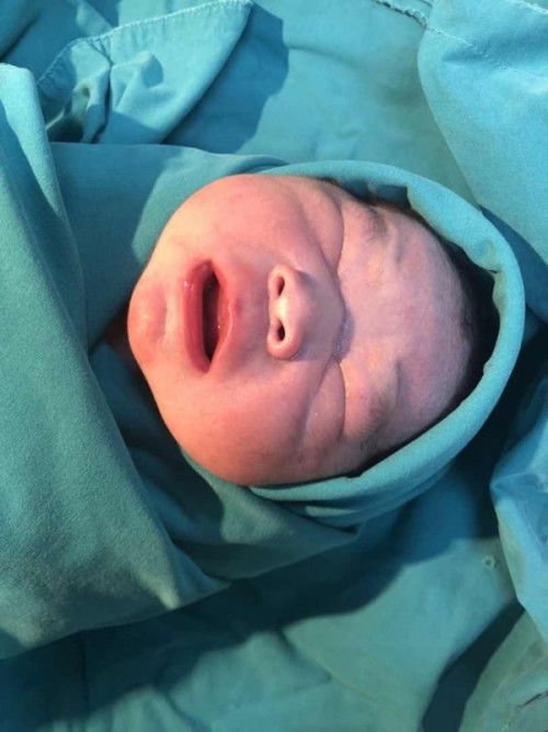 คลอดน้องแล้วค่ะ วันฉัตรมงคลพอดี เคสแรกของวัน