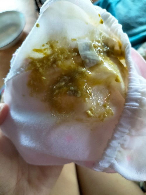 ขอสอบถามแม่ๆค่ะ