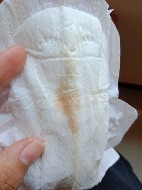 แบบนี้แสดงว่าต้องไปโรงบาลไหมค่ะ