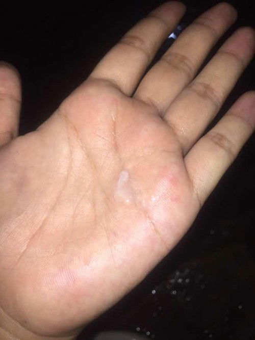 แบบนี้เรียกมูกใสหรือตกขาวค่ะ