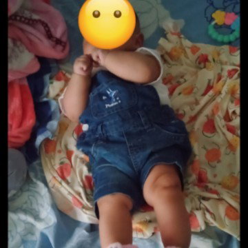 Bayi sering berkeringat