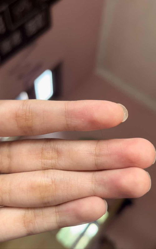 rambut bayi 28 hari rontok??