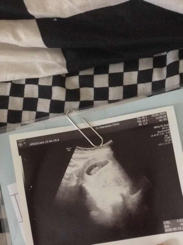 กว่าจะให้เห็นต้องรอ8วีคเลยค่ะ แม่ๆบ้านไหน ไปซาวด์ครั้งแรกไม่เจออะไรเลยบ้างคะ