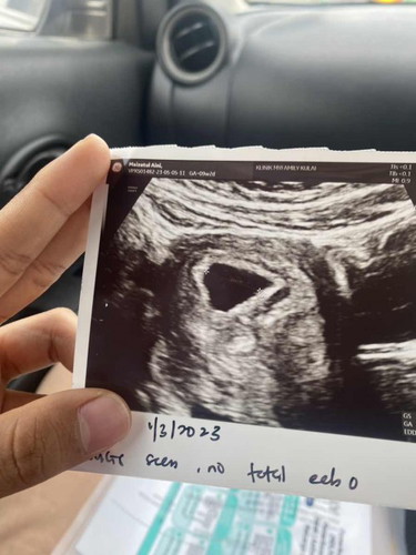 ikut kan dh 9 week tapi tadi scan baru 6 week