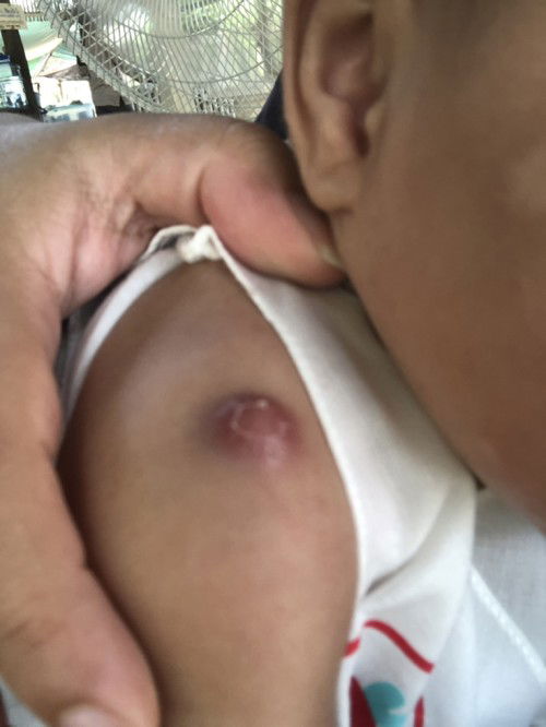 ลูกๆบ้านอื่นเป็นมั๊ยค่ะ แบบนี้จะหายมั๊ยค่ะ