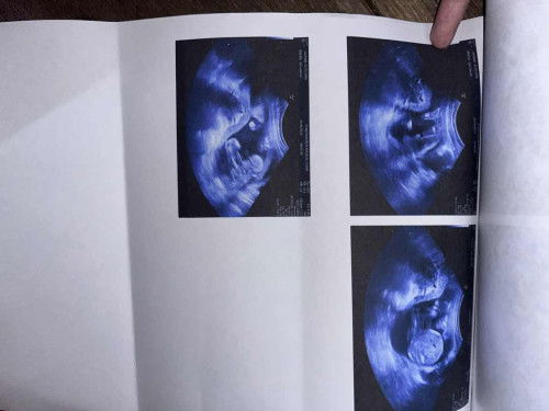 อยากทราบเพศลูกแต่ดูไม่เป้นค่ะ