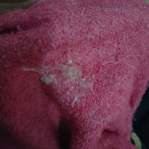 หลังจากโดนกระตุ้นปากมดลูก