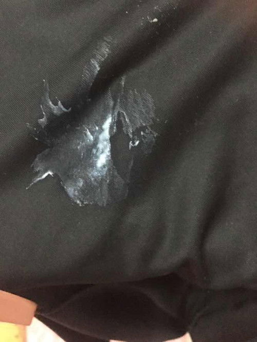 แบบนี้คือ ตกขาว ใช่ไหมค่ะ