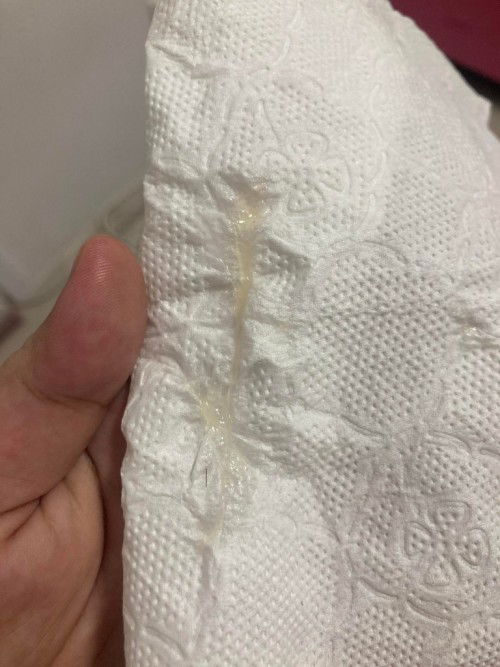 ตกขาวใสแบบนี้ใกล้แล้วใช่ไหมคะ37wแล้ว ไม่ปวดท้องท้องไม่แข็งถี่