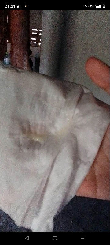 มันคืออะไรคะแม่ๆพ ดีท้องแรกนู๋ไม่รู้