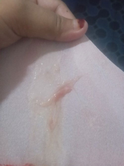 Ada flek lendir darah