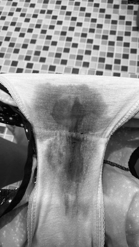 SPOTTING or BLEEDING?