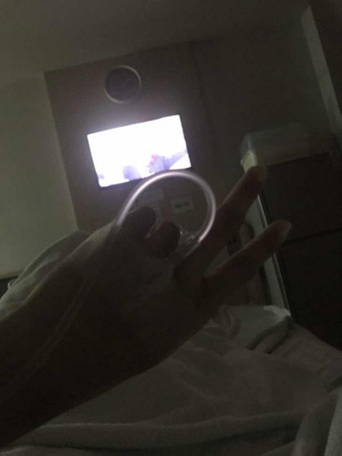 แตกแล้ว 39w + 3d😂✌️
