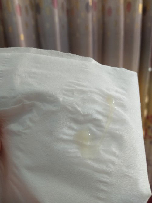 Keluar Lendir UK 38w2d