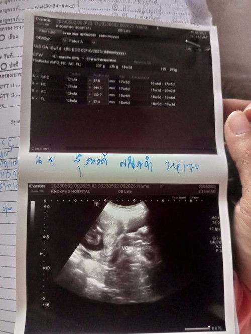 แม่ช่วยดูให้หน่อยได้ไหมคะ