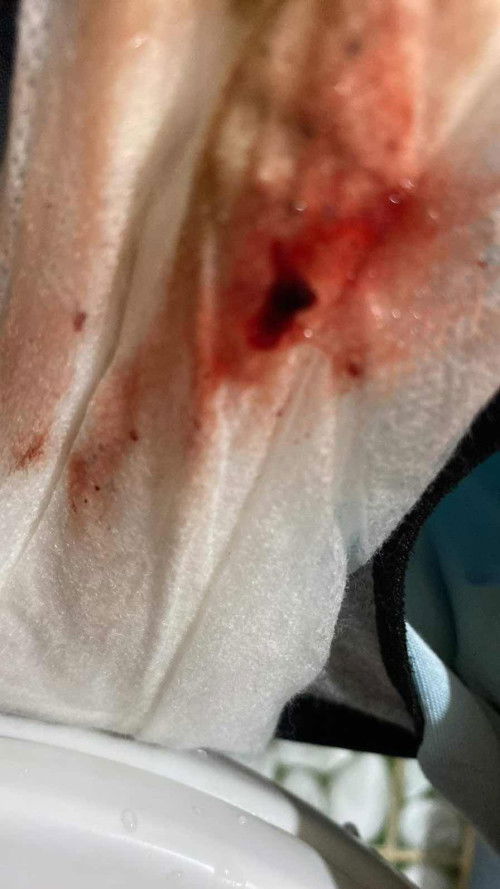 คลอดธรรมชาติ