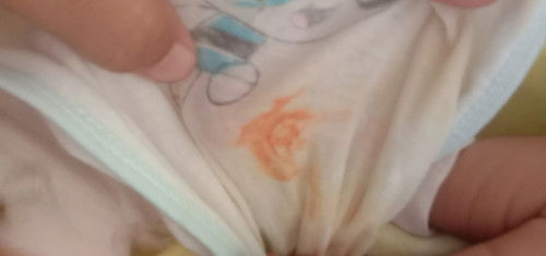 Kencing Newborn bercak darah