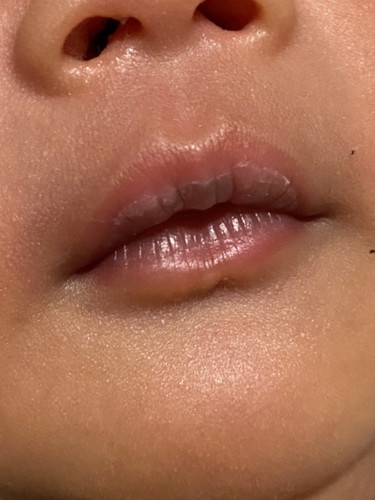 Bibir bayi beda warna