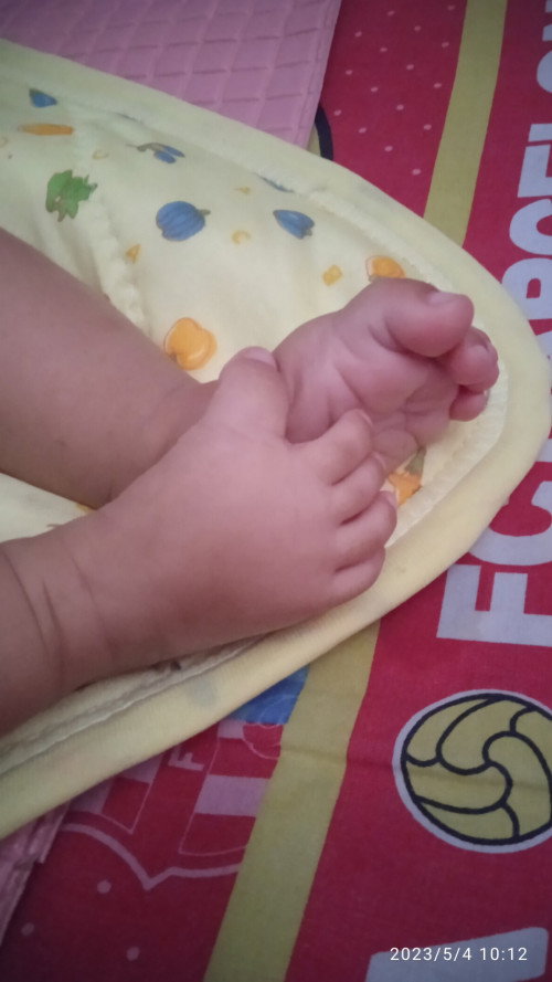 Bayi 4 bulan kakinya keringat dingin apakah wajar?