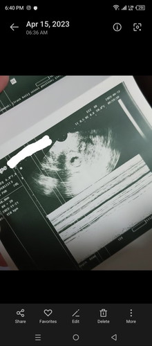 ultrasound 8 weeks and 2 days