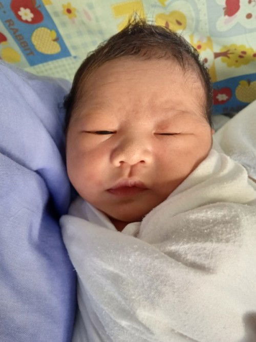 ทารกเกินกำหนด40วิค+6วัน