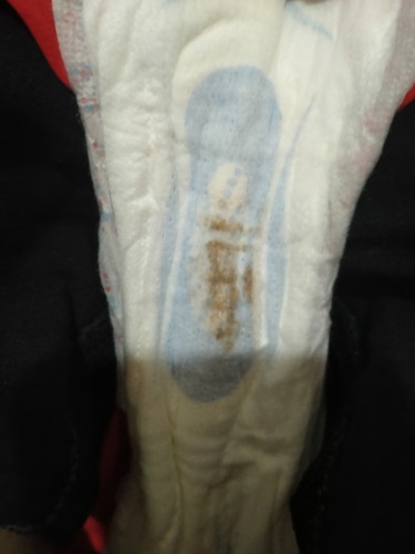 Hari ni masuk 21 Delay Period, ini implantation bleeding ke?