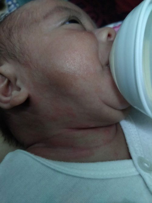 Cara rawat kulit bayi 2bulan