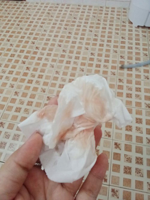 แม่ๆบ้านไหนเคยมีเลือดล้างหน้าเด็กไมคะเปนแบบไหนกันคะ