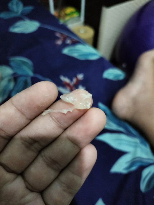 Keluar lendir 38weeks