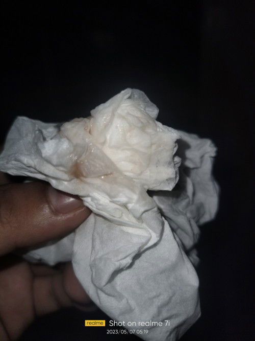 Usia 40+6 pertama keluar flek habis HB