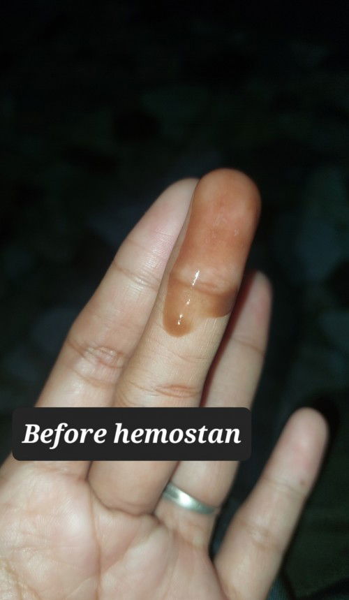 Light brown to dark discharge