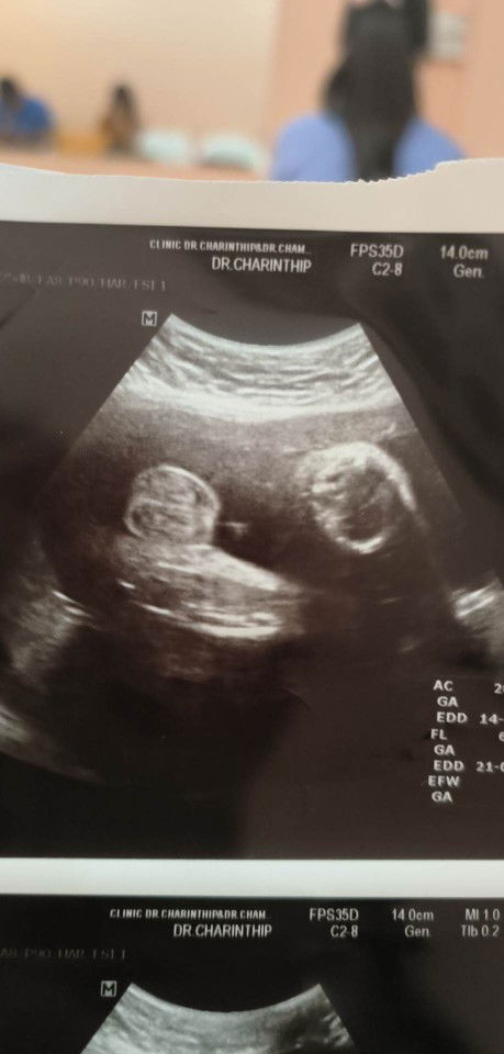 ทีมลูกชาย  ทีมมิถุนายน