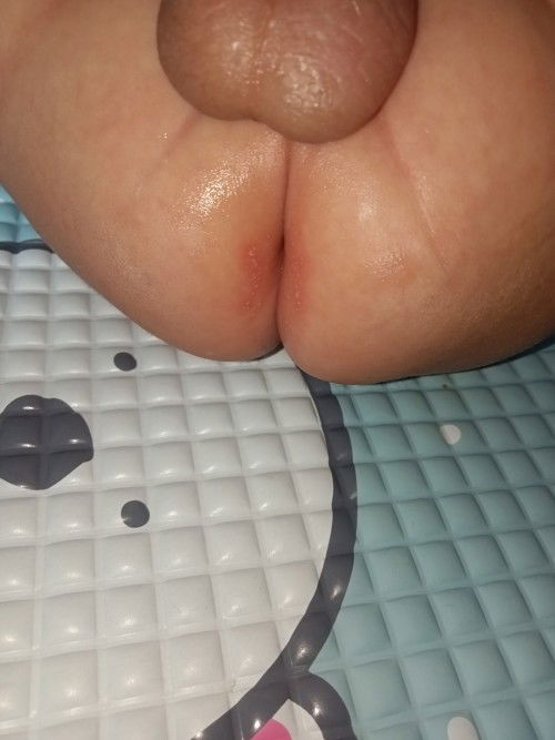 Merk diaper rash cream