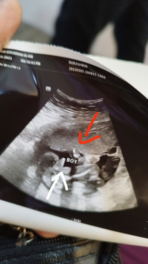 Nk tanya btul ke boy pastu mana satu alat kelamin nya saya tgok mcm yg atas tu