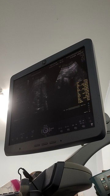 ตรวจเบาหวานครั้งแรกไม่ผ่าน