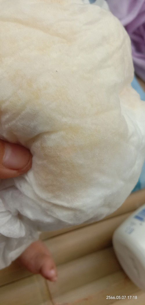 ลูกน้อยฉี่สีเข้ม