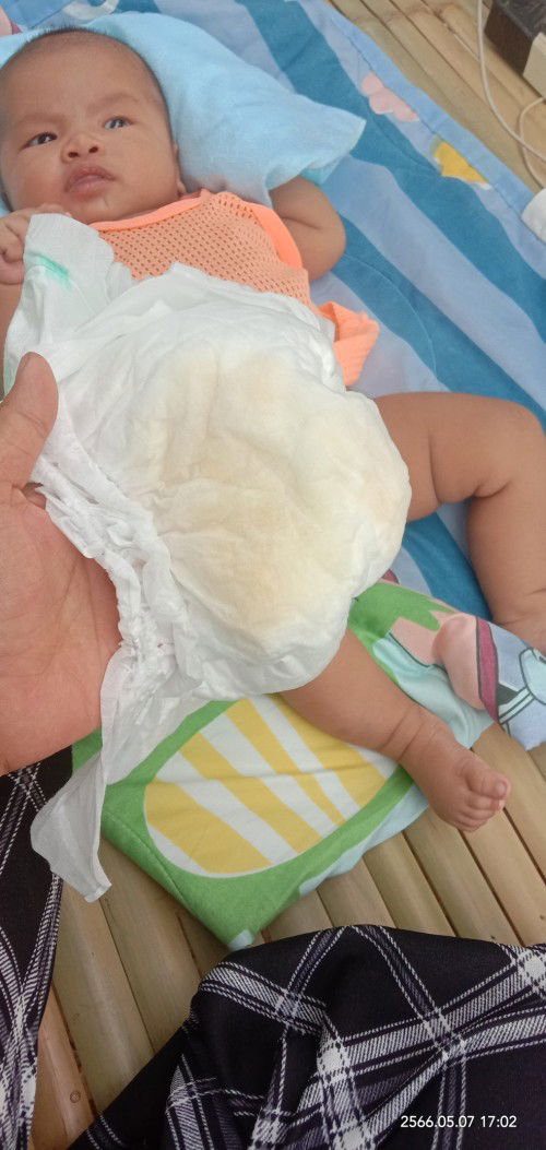 ลูกน้อยไม่ค่อยฉี่