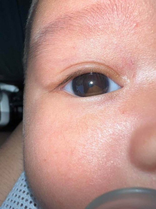 Iris mata baby berubah warna