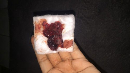 assalamualaikum bun maaf mau tanya ini tanda apa ya diawal kehamilan