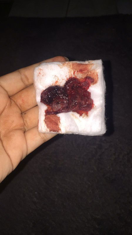 assalamualaikum bun maaf mau tanya ini tanda apa ya di awal kehamilan trmksh