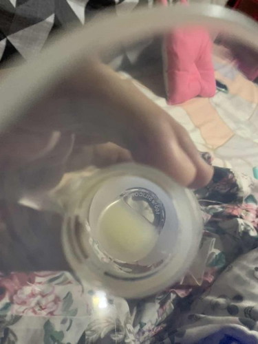 Breast milk normal color po ba