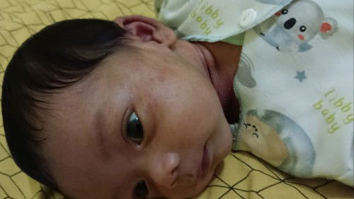 Merah merah gini kenapa yaa? :(