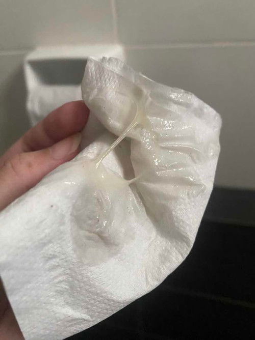 ปวดฉี่ ปวดอึ ปวดหน่วง