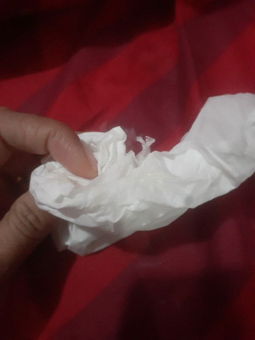 12week sering muncul keputihan