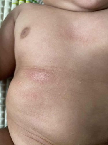 Kenapa dengan badan anak saya eh? Dulu mcm kulit kering skrg tiber banyak and macam makin teruk je