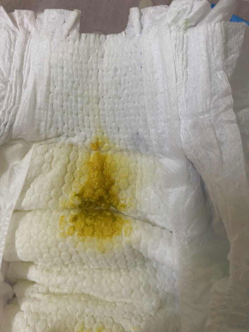 Bé đc 22 ngày tuổi