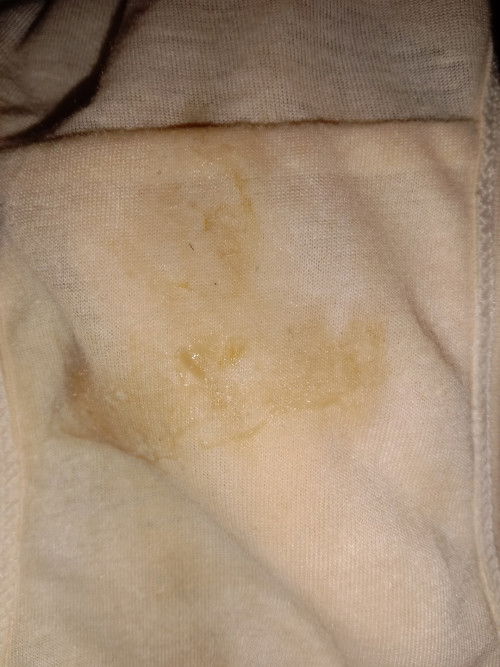 Bunda bunda mau tanya , apakah ini sudah termasuk mendekati persalinan ?